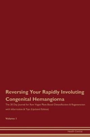 Cover of Reversing Your Rapidly Involuting Congenital Hemangioma