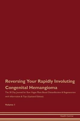 Book cover for Reversing Your Rapidly Involuting Congenital Hemangioma