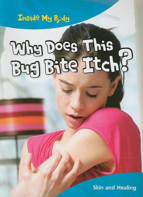 Book cover for Why Does This Bug Bite Itch?