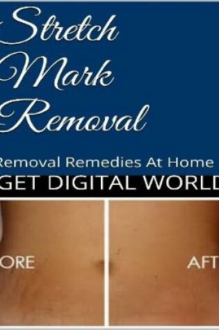 Cover of Stretch Mark Removal: Removal Remedies At Home