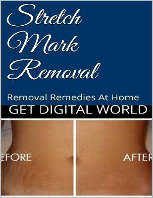 Book cover for Stretch Mark Removal: Removal Remedies At Home