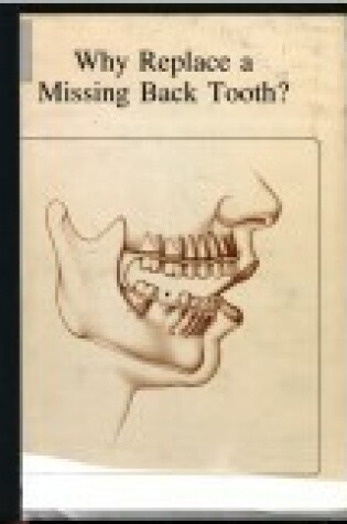 Cover of Why Replace a Missing Back Tooth?