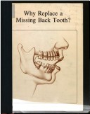 Book cover for Why Replace a Missing Back Tooth?