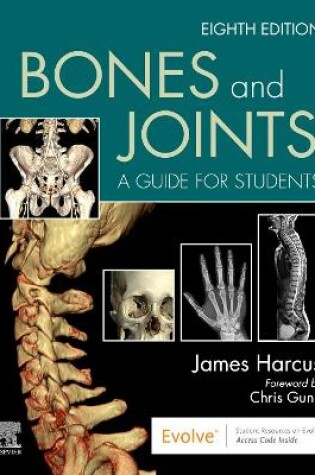 Cover of Bones and Joints - E-Book