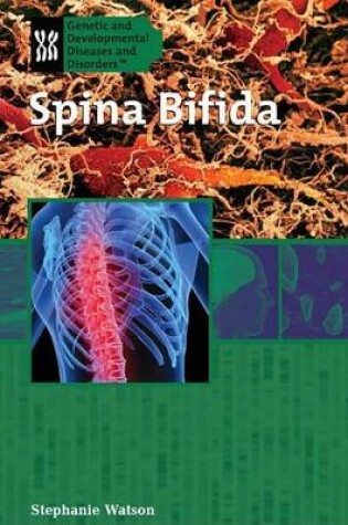 Cover of Spina Bifida