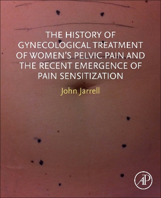 Cover of The History of Gynecological Treatment of Women’s Pelvic Pain and the Recent Emergence of Pain Sensitization