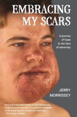 Cover of Embracing My Scars