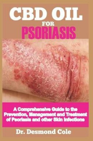 Cover of CBD Oil Psoriasis