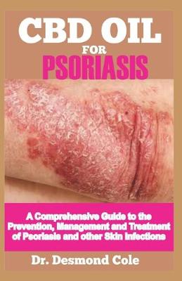 Book cover for CBD Oil Psoriasis