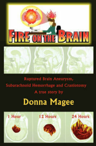 Cover of Fire on the Brain