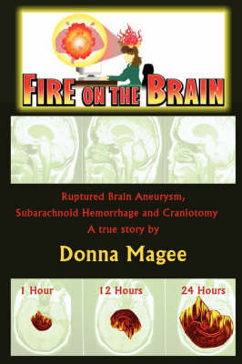 Book cover for Fire on the Brain