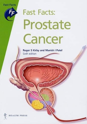 Book cover for Prostate Cancer