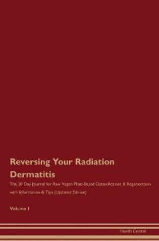 Cover of Reversing Your Radiation Dermatitis