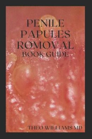 Cover of Penile Papules Romoval Book Guide