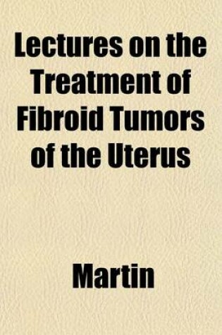 Cover of Lectures on the Treatment of Fibroid Tumors of the Uterus