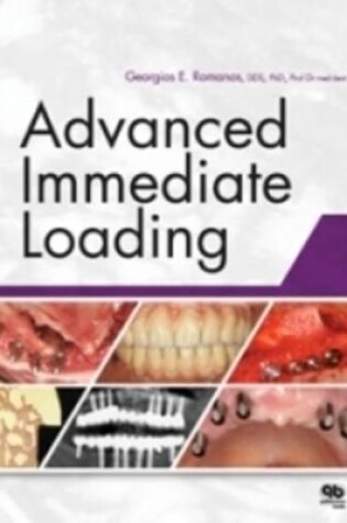 Cover of Advanced Immediate Loading