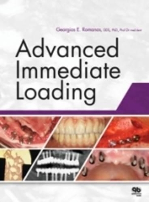 Cover of Advanced Immediate Loading