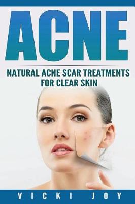 Book cover for Acne