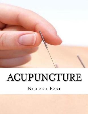 Book cover for Acupuncture