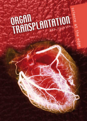Book cover for Organ Transplantation