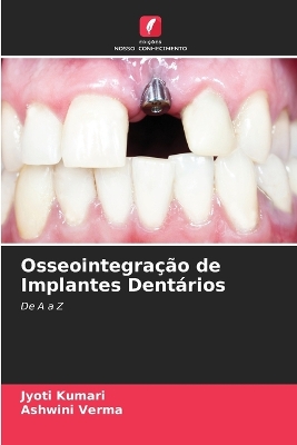 Cover of Osseointegração de Implantes Dentários