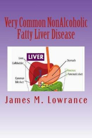 Cover of Very Common NonAlcoholic Fatty Liver Disease