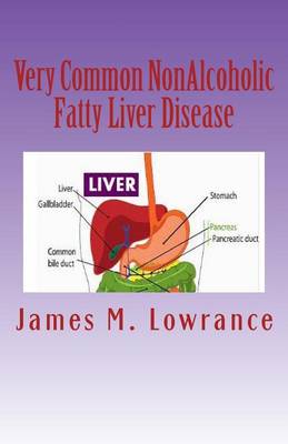 Book cover for Very Common NonAlcoholic Fatty Liver Disease