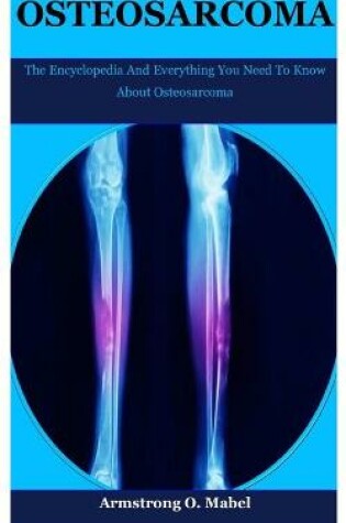 Cover of Osteosarcoma