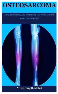 Book cover for Osteosarcoma