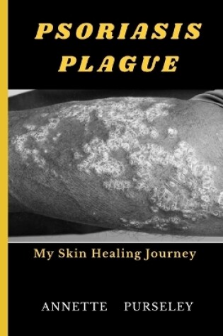 Cover of Psoriasis Plague