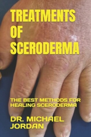 Cover of Treatments of Sceroderma