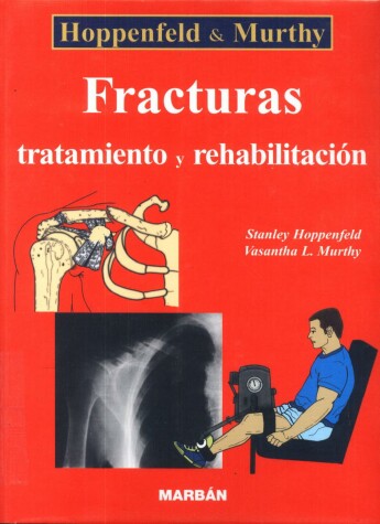 Cover of FRACTURAS. TRATAMIENTO Y REHABILITACION