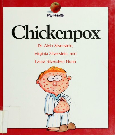 Cover of Chickenpox