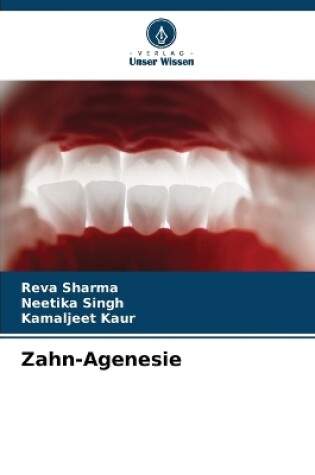 Cover of Zahn-Agenesie