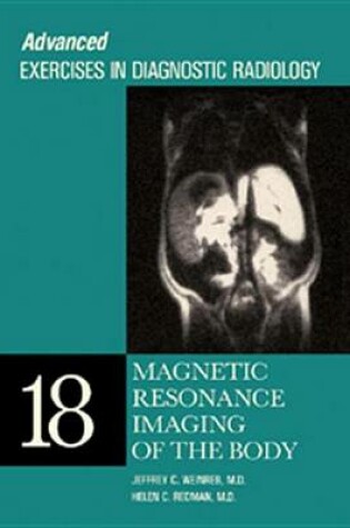 Cover of Magnetic Resonance Imaging of the Body