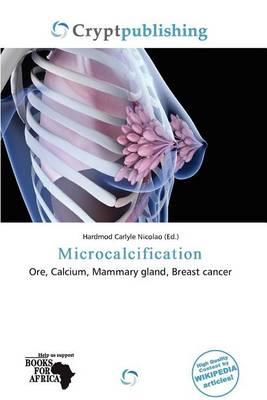 Book cover for Microcalcification