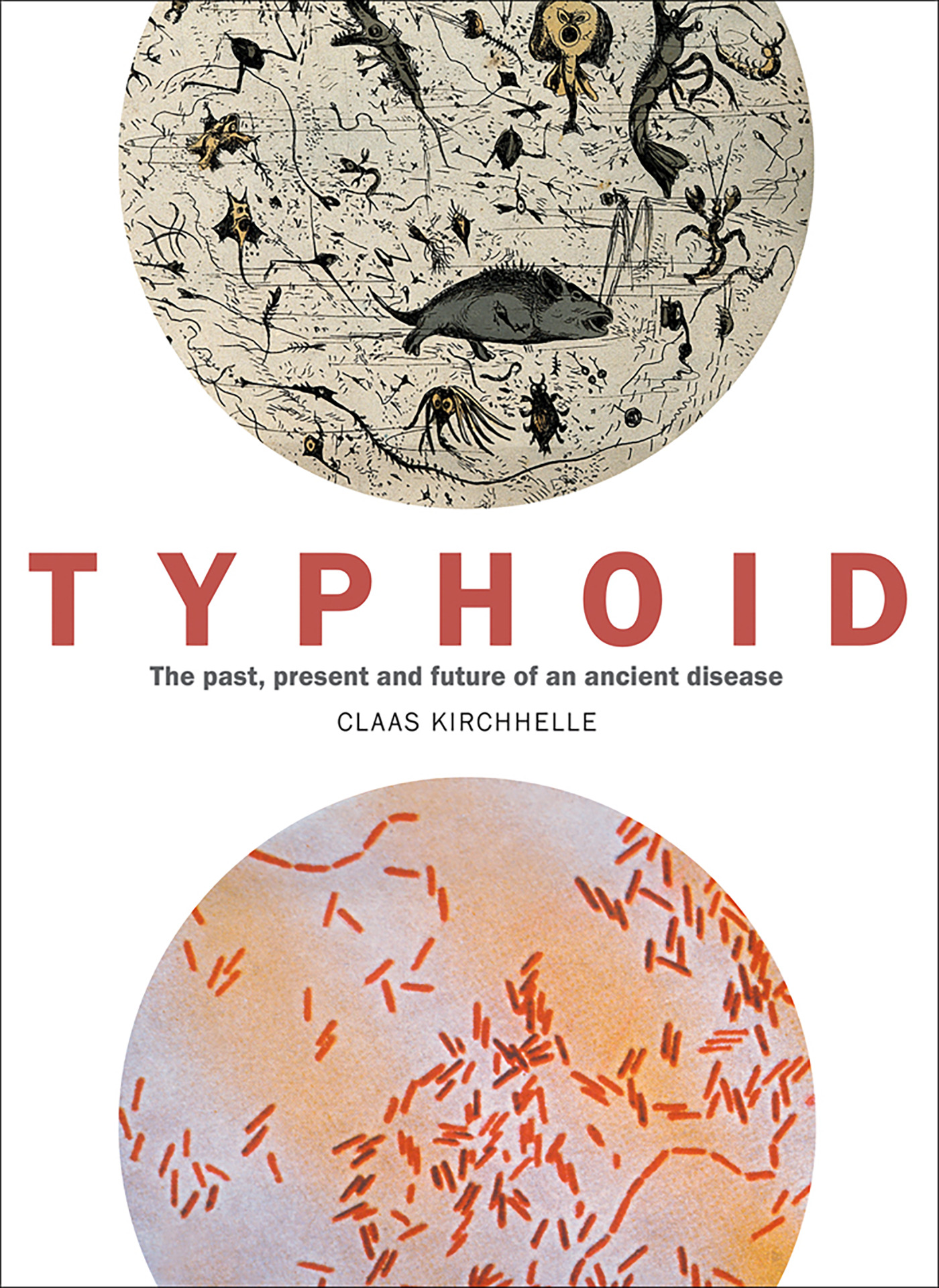 Cover of Typhoid