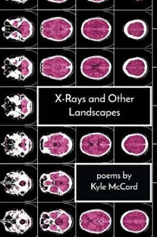 Cover of X-Rays and Other Landscapes