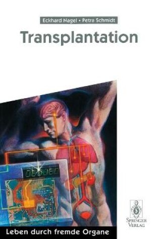 Cover of Transplantation