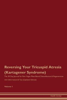 Book cover for Reversing Your Tricuspid Atresia (Kartagener Syndrome)