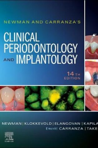 Cover of Newman and Carranza's Clinical Periodontology and Implantology