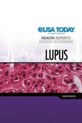 Cover of Lupus