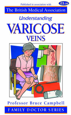 Cover of Understanding Varicose Veins