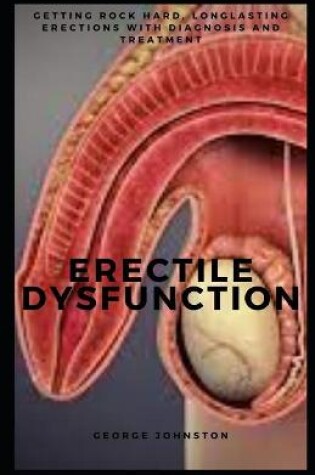 Cover of Erectile Dysfunction