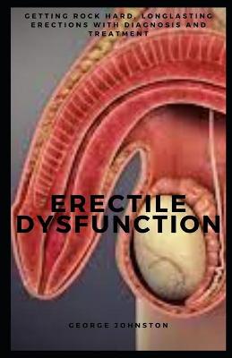 Book cover for Erectile Dysfunction