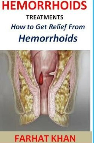 Cover of Hemorrhoid Treatments