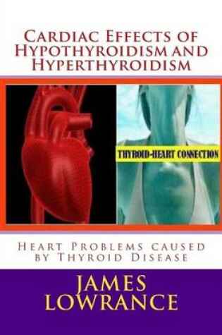 Cover of Cardiac Effects of Hypothyroidism and Hyperthyroidism