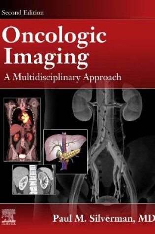 Cover of Oncologic Imaging: A Multidisciplinary Approach E-Book