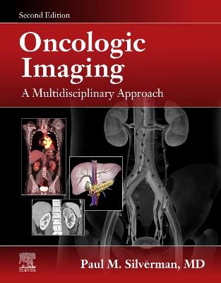 Cover of Oncologic Imaging: A Multidisciplinary Approach E-Book