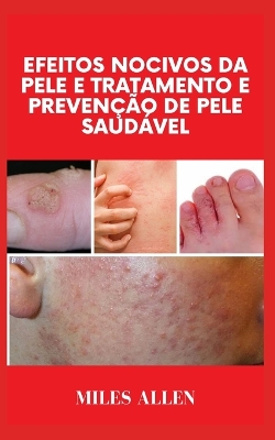 Book cover for Efeitos Nocivos Da Pele E Tratamento E Prevenção de Pele Saudável